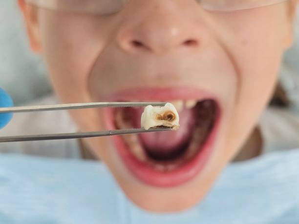 Best Pediatric Emergency Dentist in Wilmington, DE